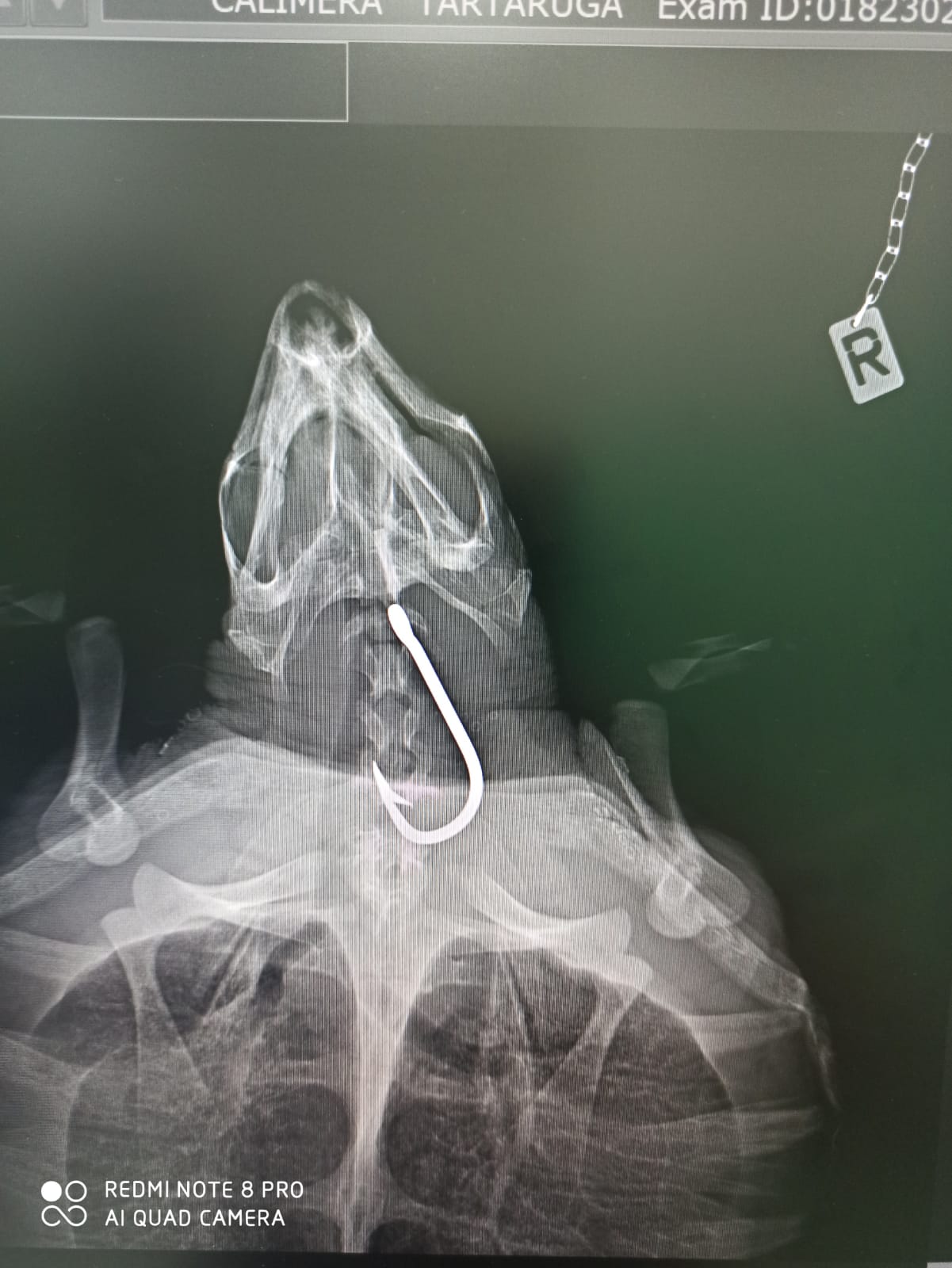 Questa tartaruga marina è stata rinvenuta con un grande amo in gola e per fortuna, grazie ad un intervento chirurgico di emergenza, siamo riusciti a darle una seconda possibilità, una seconda vita. foto da: Plastc Free